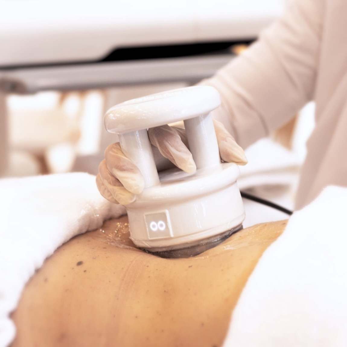 Adipologie tretman tijela u salonu Val Beauté